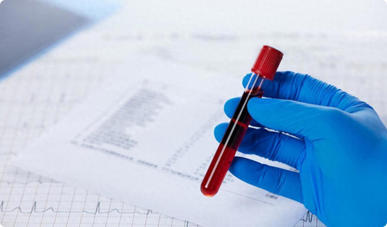 有糖尿病的人，5个测血糖的坑，踩一个就等于白测了！