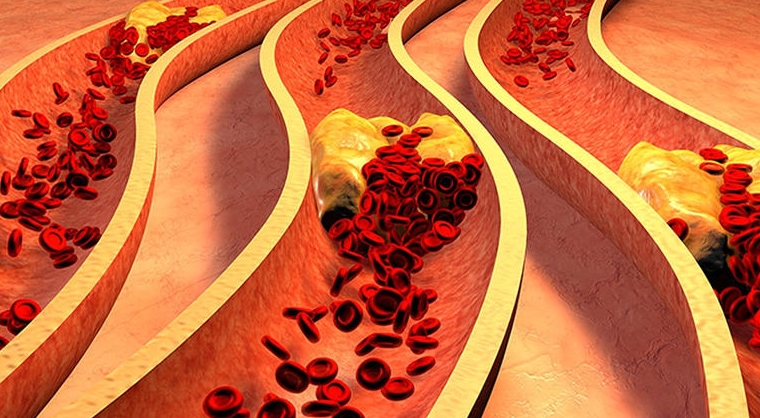 血管老化加速全身衰老! 医生都在做的3个护血管运动